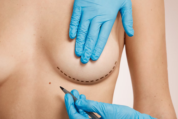 Areola-Pigmentation-With-Reconstruction